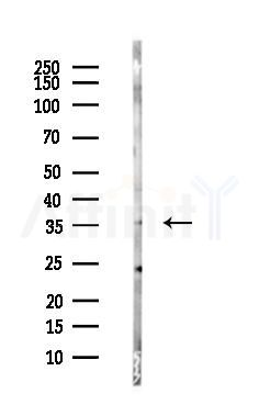SCAMP2 Antibody - Western blot analysis of lysates from COLO205 cells(LPS, 4h treatment), using SCAMP2 Antibody at 1/1000 dilution.