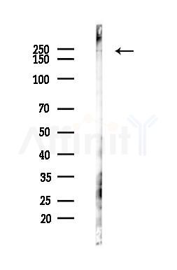Proteasome Activator Subunit 4 Antibody - Western blot analysis of lysates from Hela cells(heat-shock,45min treatment), using Proteasome Activator Subunit 4 Antibody at 1/1000 dilution.