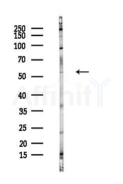 FLIP Antibody - Western blot analysis of lysates from Hela cells(heat-shock,45min treatment), using FLIP Antibody at 1/1000 dilution.