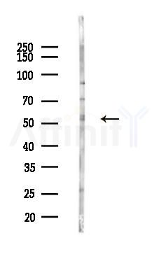 FLIP Antibody - Western blot analysis of lysates from Mouse liver, using FLIP Antibody at 1/1000 dilution.