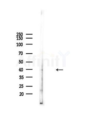 LHX6 Antibody - Western blot analysis of lysates from Mouse liver, using LHX6 Antibody at 1/1000 dilution.