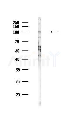 YTHDC1 Antibody - Western blot analysis of lysates from HUVEC cells(heat-shock,45min treatment), using YTHDC1 Antibody at 1/1000 dilution.