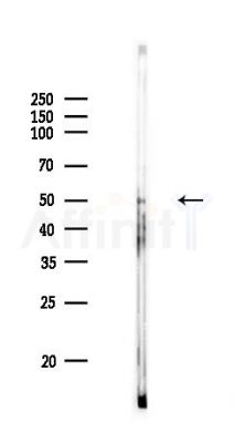 DDX39B Antibody - Western blot analysis of lysates from PC12 cells, using DDX39B Antibody at 1/1000 dilution.