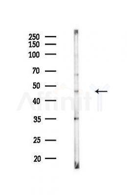 GSDMB Antibody - Western blot analysis of lysates from HUVEC cells(heat-shock,45min treatment), using GSDMB Antibody at 1/1000 dilution.