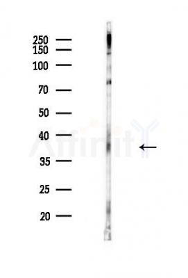 IDO2 Antibody - Western blot analysis of lysates from Hela cells(heat-shock,45min treatment), using IDO2 Antibody at 1/1000 dilution.