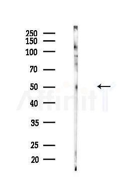 IDO2 Antibody - Western blot analysis of lysates from HUVEC cells(heat-shock,45min treatment), using IDO2 Antibody at 1/1000 dilution.