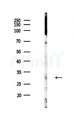 VDAC3 Antibody - Western blot analysis of lysates from Hela cells(heat-shock,45min treatment), using VDAC3 Antibody at 1/1000 dilution.