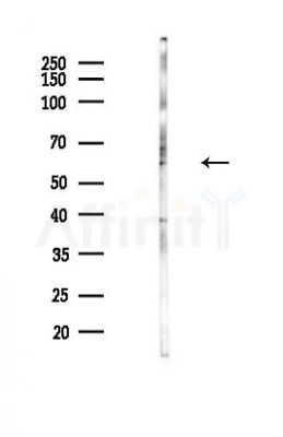 SEMA3G Antibody - Western blot analysis of lysates from Hela cells(heat-shock,45min treatment), using SEMA3G Antibody at 1/1000 dilution.