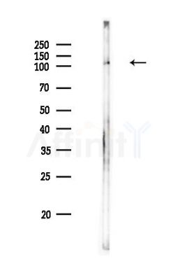 TRIAD3 Antibody - Western blot analysis of lysates from PC12 cells, using TRIAD3 Antibody at 1/1000 dilution.