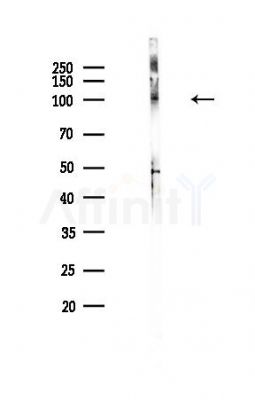 SOX30 Antibody - Western blot analysis of lysates from Hela cells(heat-shock,45min treatment), using SOX30 Antibody at 1/1000 dilution.