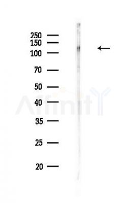 RNF40 Antibody - Western blot analysis of lysates from HUVEC cells(heat-shock,45min treatment), using RNF40 Antibody at 1/1000 dilution.
