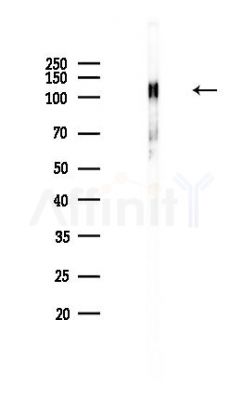 Calpastatin Antibody - Western blot analysis of lysates from Hela cells(heat-shock,45min treatment), using Calpastatin Antibody at 1/1000 dilution.