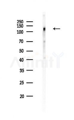 Calpastatin Antibody - Western blot analysis of lysates from HUVEC cells(heat-shock,45min treatment), using Calpastatin Antibody at 1/1000 dilution.