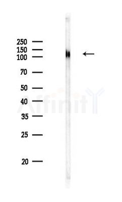 Calpastatin Antibody - Western blot analysis of lysates from PC12 cells, using Calpastatin Antibody at 1/1000 dilution.
