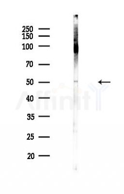 ONECUT2 Antibody - Western blot analysis of lysates from Hela cells(heat-shock,45min treatment), using ONECUT2 Antibody at 1/1000 dilution.