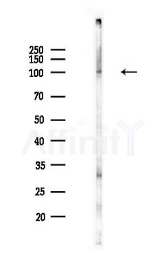 ADAMTS15 Antibody - Western blot analysis of lysates from Hela cells(heat-shock,45min treatment), using ADAMTS15 Antibody at 1/1000 dilution.