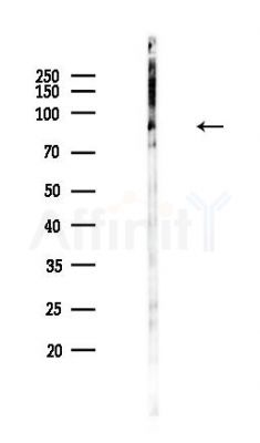 ZFP91 Antibody - Western blot analysis of lysates from Hela cells(heat-shock,45min treatment), using ZFP91 Antibody at 1/1000 dilution.