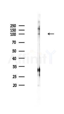 ZFP91 Antibody - Western blot analysis of lysates from PC12 cells, using ZFP91 Antibody at 1/1000 dilution.