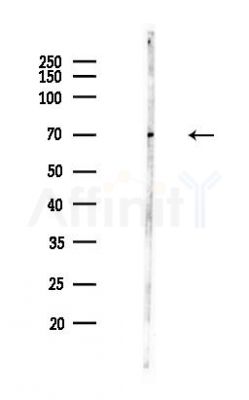 PPM1D Antibody - Western blot analysis of lysates from Hela cells(heat-shock,45min treatment), using PPM1D Antibody at 1/1000 dilution.