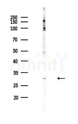 CTRP5 Antibody - Western blot analysis of lysates from Hela cells(heat-shock,45min treatment), using CTRP5 Antibody at 1/1000 dilution.