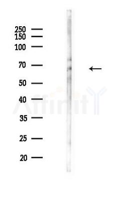 Scavenger Receptor BII Antibody - Western blot analysis of lysates from Hela cells(heat-shock,45min treatment), using Scavenger Receptor BII Antibody at 1/1000 dilution.