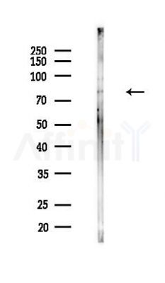 Scavenger Receptor BII Antibody - Western blot analysis of lysates from HUVEC cells(heat-shock,45min treatment), using Scavenger Receptor BII Antibody at 1/1000 dilution.