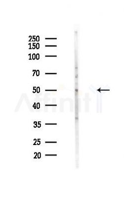 DNA polymerase delta p50 Antibody - Western blot analysis of lysates from HUVEC cells(heat-shock,45min treatment), using DNA polymerase delta p50 Antibody at 1/1000 dilution.