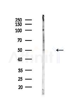 GCNF Antibody - Western blot analysis of lysates from HUVEC cells(heat-shock,45min treatment), using GCNF Antibody at 1/1000 dilution.