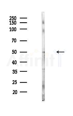 Semaphorin 3B Antibody - Western blot analysis of lysates from Hela cells(heat-shock,45min treatment), using Semaphorin 3B Antibody at 1/1000 dilution.