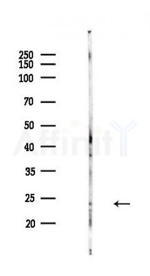 RPL13 Antibody - Western blot analysis of lysates from Hela cells(heat-shock,45min treatment), using RPL13 Antibody at 1/1000 dilution.