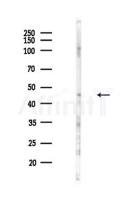 GTPBP9 Antibody - Western blot analysis of lysates from Hela cells(heat-shock,45min treatment), using GTPBP9 Antibody at 1/1000 dilution.
