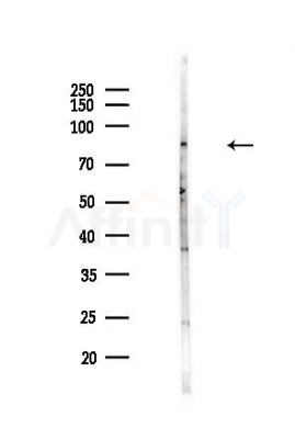PARP6 Antibody - Western blot analysis of lysates from Hela cells(heat-shock,45min treatment), using PARP6 Antibody at 1/1000 dilution.
