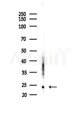 BTF3 Antibody - Western blot analysis of lysates from LoVo cells(heat-shock,45min treatment), using BTF3 Antibody at 1/1000 dilution.