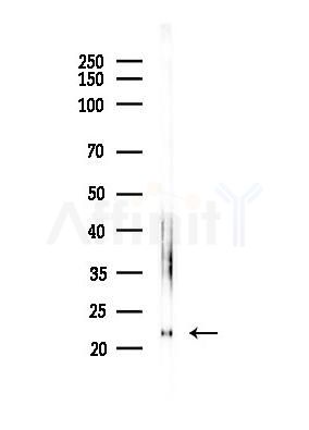 BTF3 Antibody - Western blot analysis of lysates from Hela cells(heat-shock,45min treatment), using BTF3 Antibody at 1/1000 dilution.