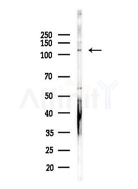PTIP Antibody - Western blot analysis of lysates from Hela cells(heat-shock,45min treatment), using PTIP Antibody at 1/1000 dilution.