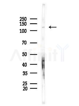 PTIP Antibody - Western blot analysis of lysates from PC12 cells, using PTIP Antibody at 1/1000 dilution.