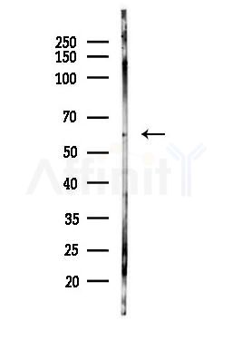 MKRN1 Antibody - Western blot analysis of lysates from Hela cells(heat-shock,45min treatment), using MKRN1 Antibody at 1/1000 dilution.