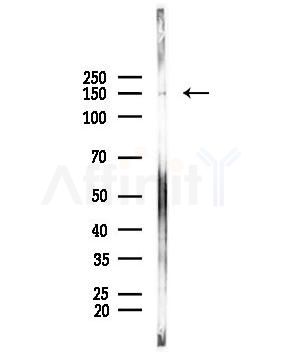 HIP1R Antibody - Western blot analysis of lysates from PC12 cells, using HIP1R Antibody at 1/1000 dilution.