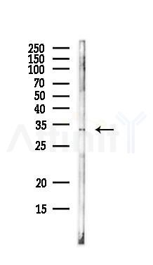 Pit1 Antibody - Western blot analysis of lysates from EC304 cells(LPS, 4h treatment), using Pit1 Antibody at 1/1000 dilution.