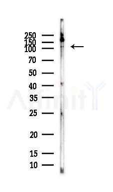 Exportin T Antibody - Western blot analysis of lysates from HepG2 cells(LPS, 4h treatment), using Exportin T Antibody at 1/1000 dilution.