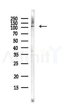 Exportin T Antibody - Western blot analysis of lysates from EC304 cells(LPS, 4h treatment), using Exportin T Antibody at 1/1000 dilution.