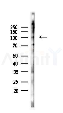 Exportin T Antibody - Western blot analysis of lysates from Mouse lung, using Exportin T Antibody at 1/1000 dilution.