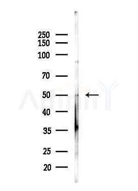 ANKH Antibody - Western blot analysis of lysates from LoVo cells(heat-shock,45min treatment), using ANKH Antibody at 1/1000 dilution.