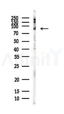 TFIP11 Antibody - Western blot analysis of lysates from HepG2 cells(LPS, 4h treatment), using TFIP11 Antibody at 1/1000 dilution.