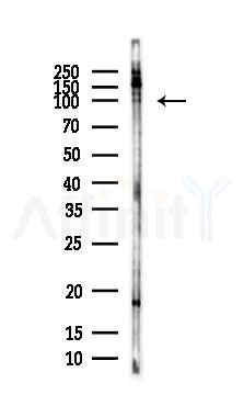 CHREBP Antibody - Western blot analysis of lysates from HepG2 cells(LPS, 4h treatment), using CHREBP Antibody at 1/1000 dilution.