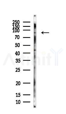 RICH2 Antibody - Western blot analysis of lysates from HepG2 cells(LPS, 4h treatment), using RICH2 Antibody at 1/1000 dilution.