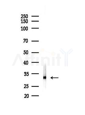 VAPA Antibody - Western blot analysis of lysates from LoVo cells(heat-shock,45min treatment), using VAPA Antibody at 1/1000 dilution.