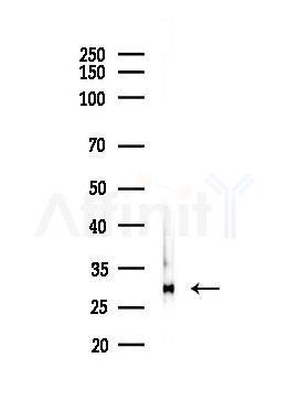 VAPA Antibody - Western blot analysis of lysates from Hela cells(heat-shock,45min treatment), using VAPA Antibody at 1/1000 dilution.