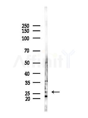 ZNF313 Antibody - Western blot analysis of lysates from PC12 cells, using ZNF313 Antibody at 1/1000 dilution.