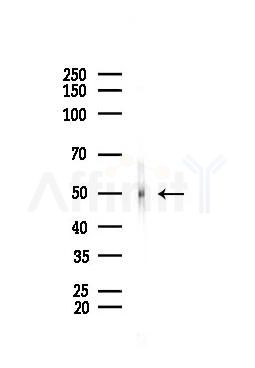 Argininosuccinate Lyase Antibody - Western blot analysis of lysates from PC12 cells, using Argininosuccinate Lyase Antibody at 1/1000 dilution.